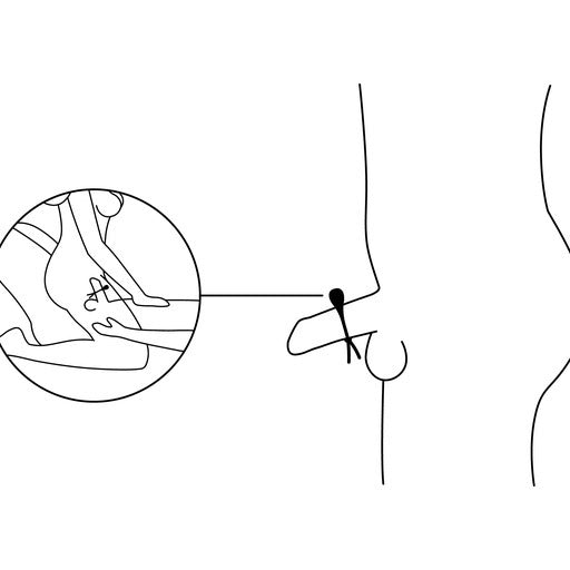Lasso cockring application diagram