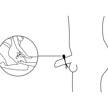 Lasso cockring application diagram